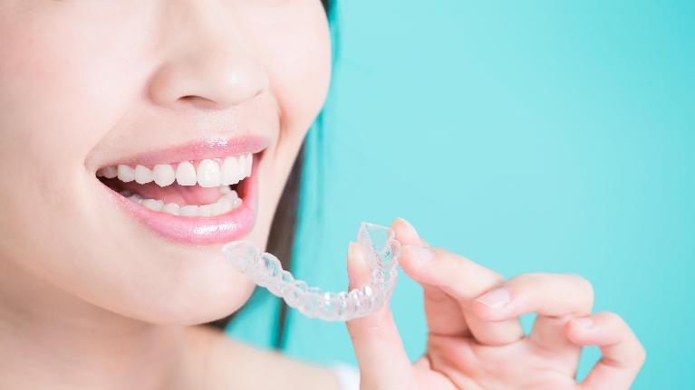 What to Expect Once You Finish Invisalign Treatment