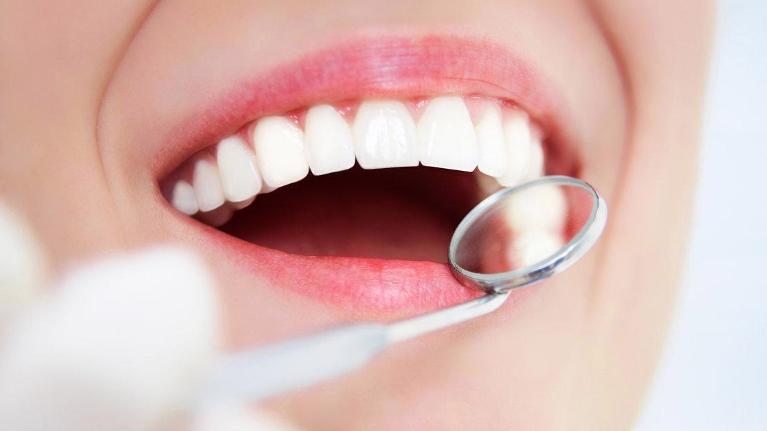 Why Many People Opt for Veneers