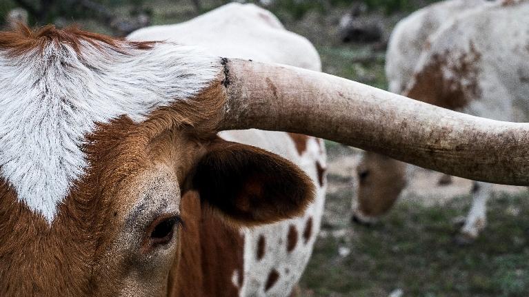 Why Texas is One of the Worst States for Dental Health