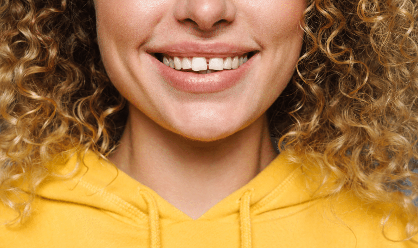 Understanding the Causes and Treatment Options for Diastema