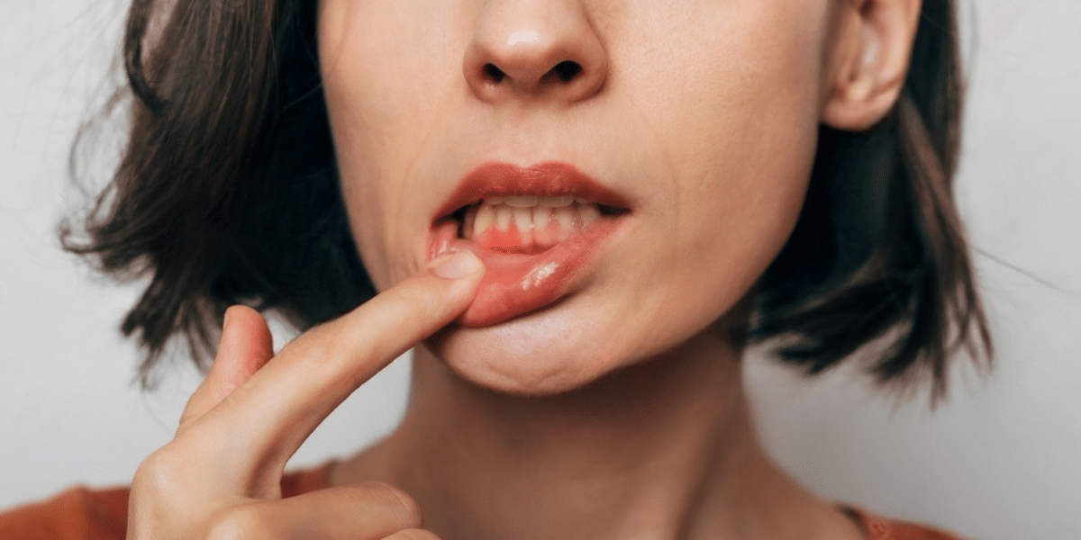 All About Emergency Dental Care