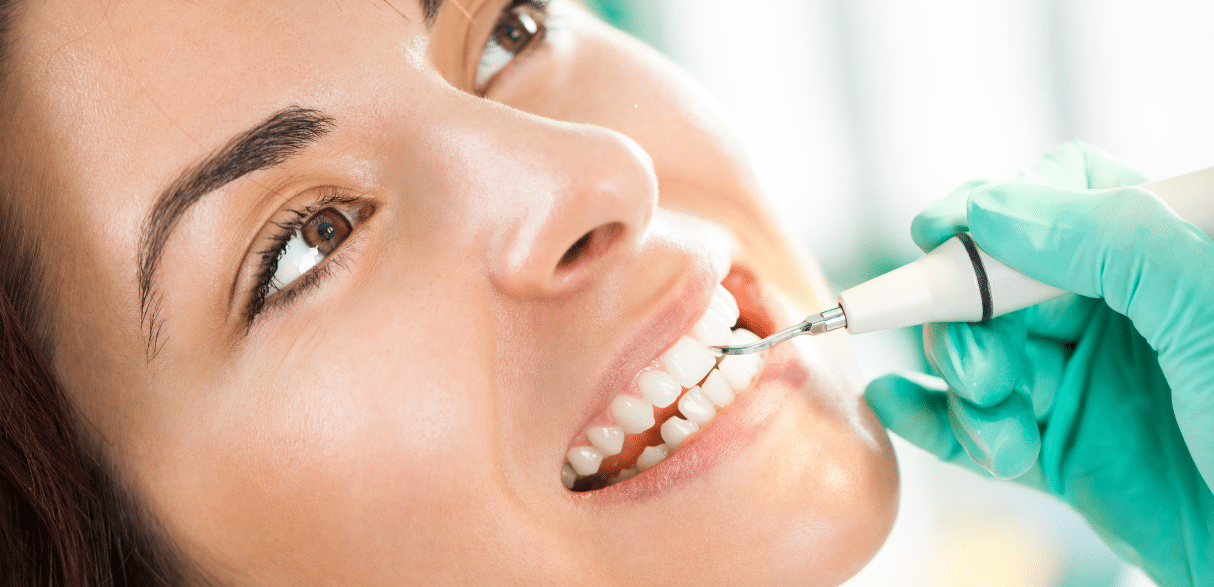 Yellow Stains on Your Teeth? How Professional Cleanings Can Help