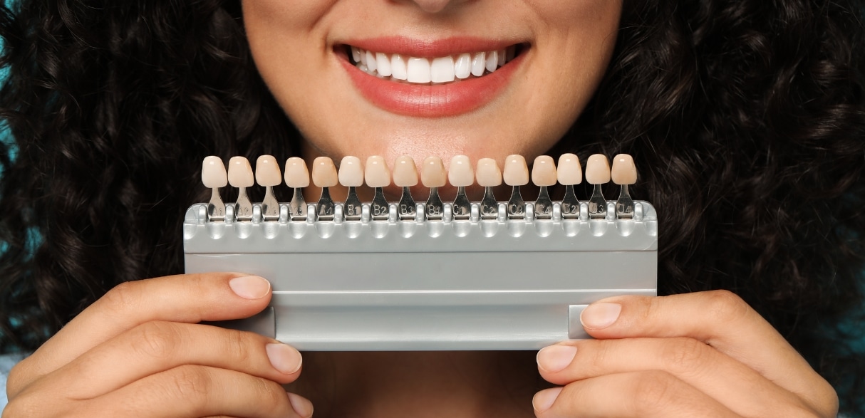 Porcelain Veneers For Chipped Teeth: The Ultimate Fix For A Flawless Smile 
