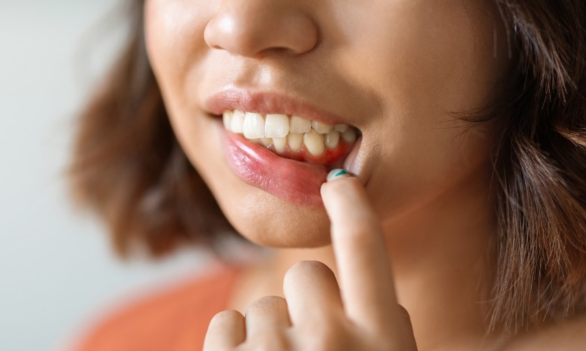 dentist in nederland