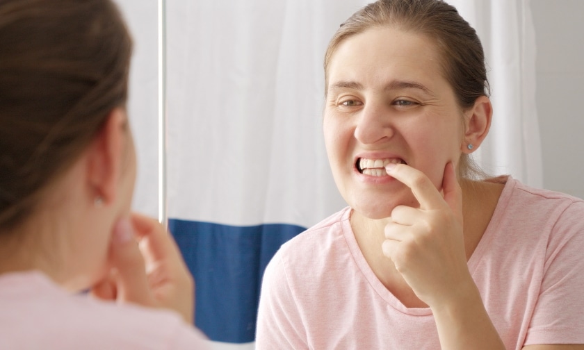 What Is Plaque vs Tartar and Why Can’t I Just Brush It Away at Home?