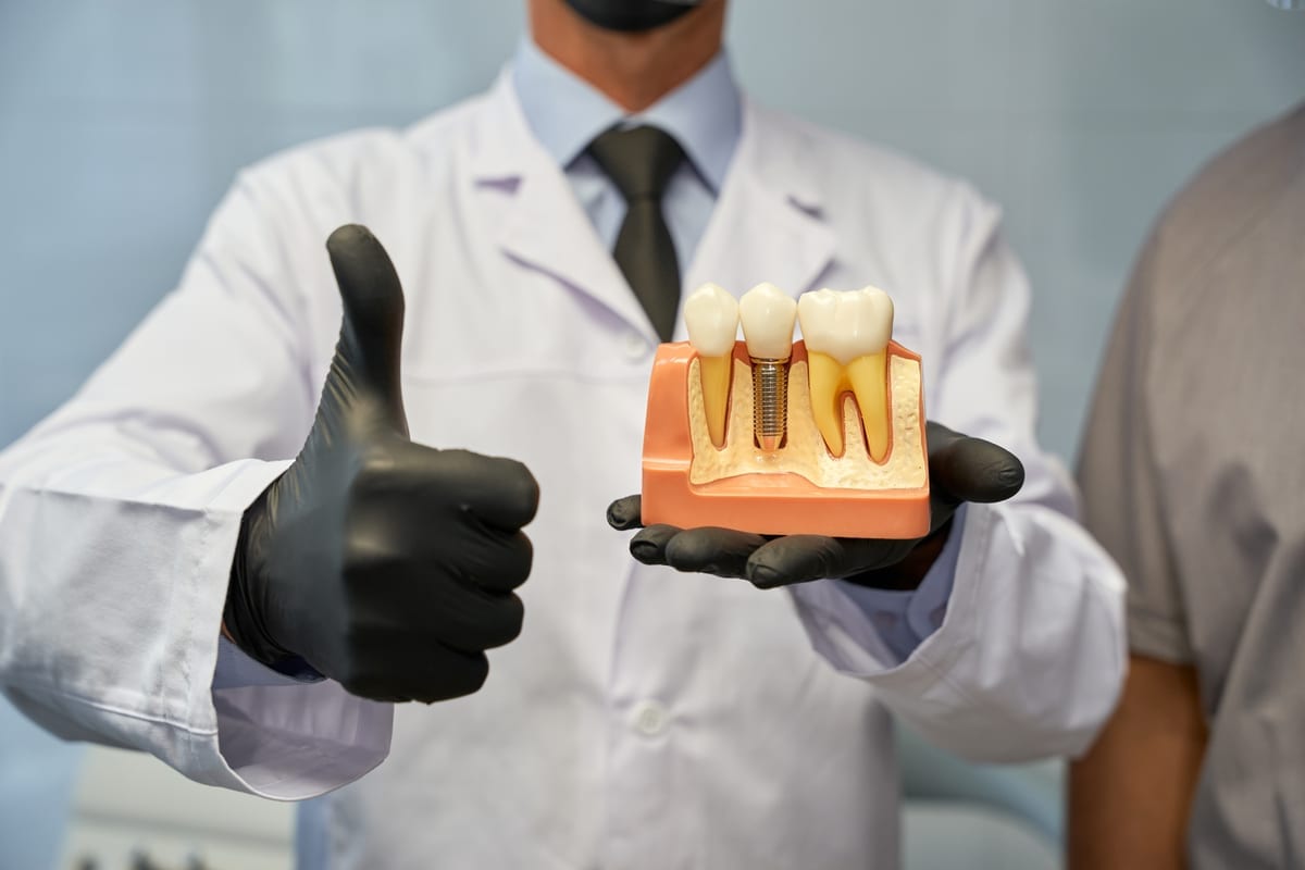 Dental Implants in Nederland