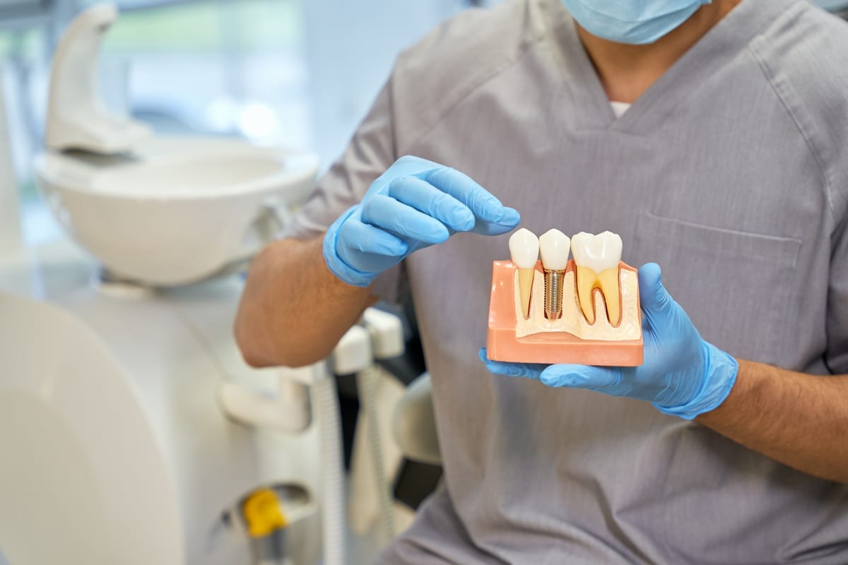 implant supported dentures in Nederland