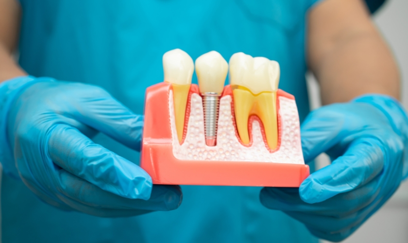 dental implants in New Port Richey