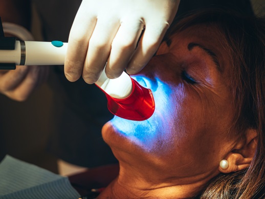 Preparing for a Special Event?Fast Cosmetic Dental Options in New Port Richey