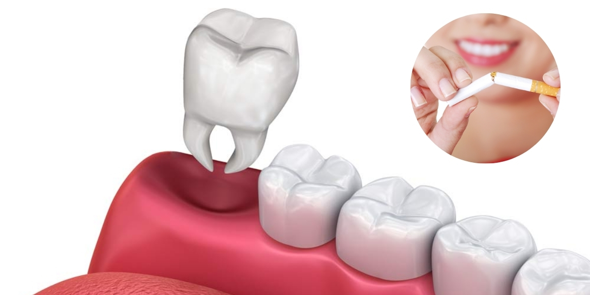 can i smoke 1 cigarette after tooth extraction Smoking After Tooth Extraction: What You Need to Know