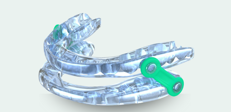 Sleepless Nights and Dental Health: Could You Benefit from Sleep Dentistry?