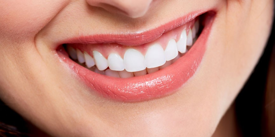 How to Prepare for a Smile Makeover: A Step-by-Step Guide