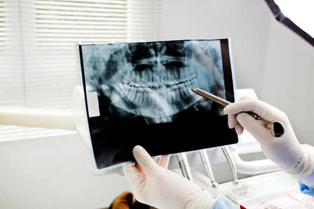 Why Do Routine Dental Exams Matter to Your Overall Health?