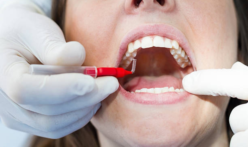 Patient's mouth with red gum tissue being examined