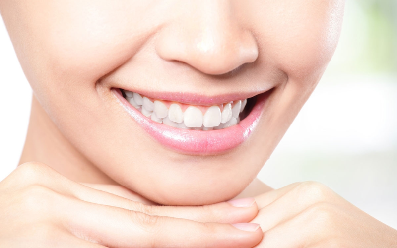 Patient smiling with bright white teeth after dental treatment