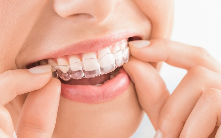 Patient holding Invisalign aligner tray for teeth straightening