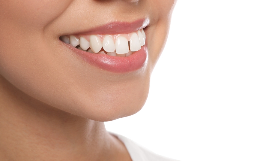 Patient with an overbite dental condition