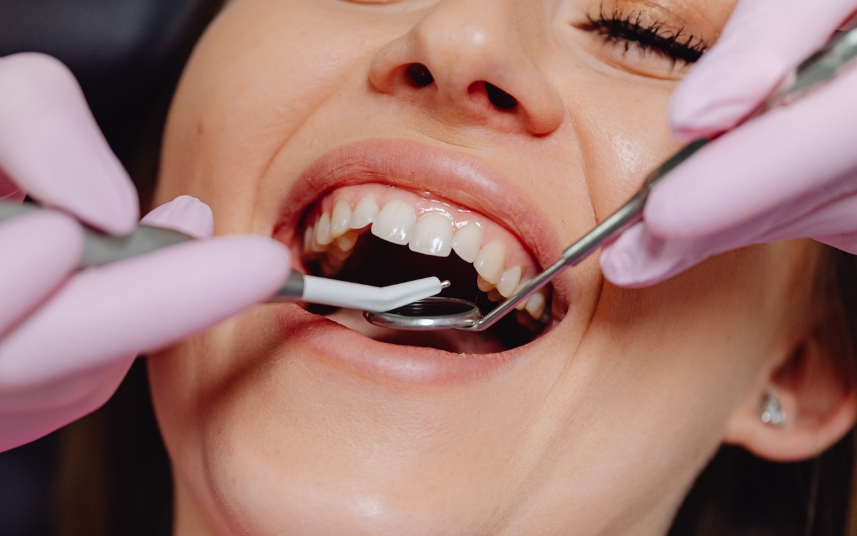Patient receiving PRF treatment as part of cosmetic dentistry