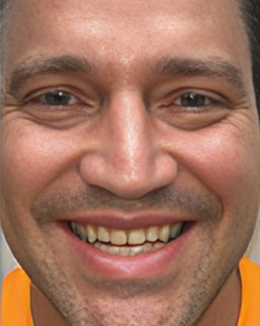 before cosmetic dental treatment