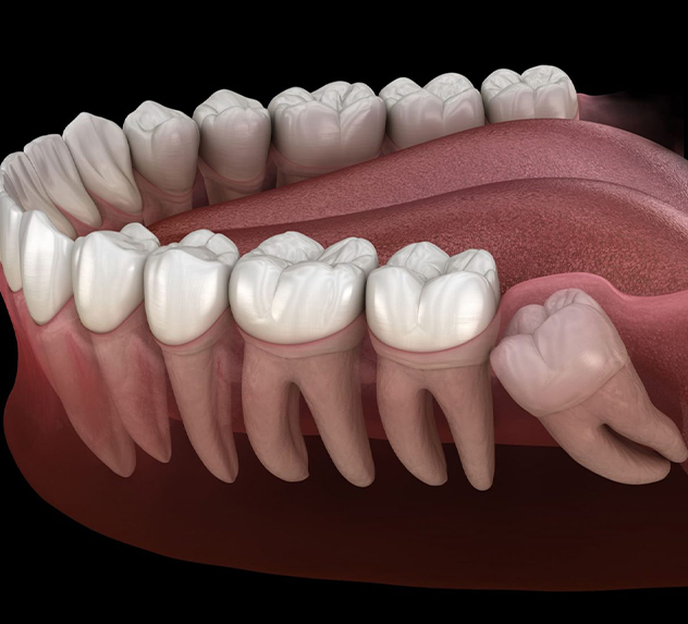 Back Teeth 