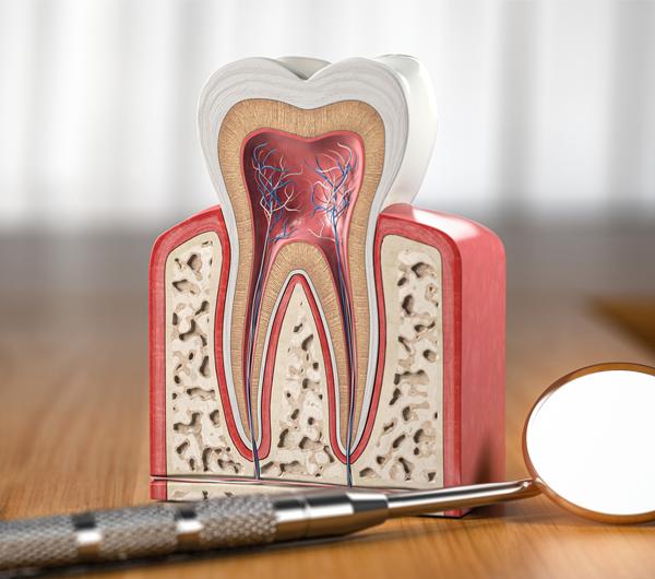 Root Canals McMurray 