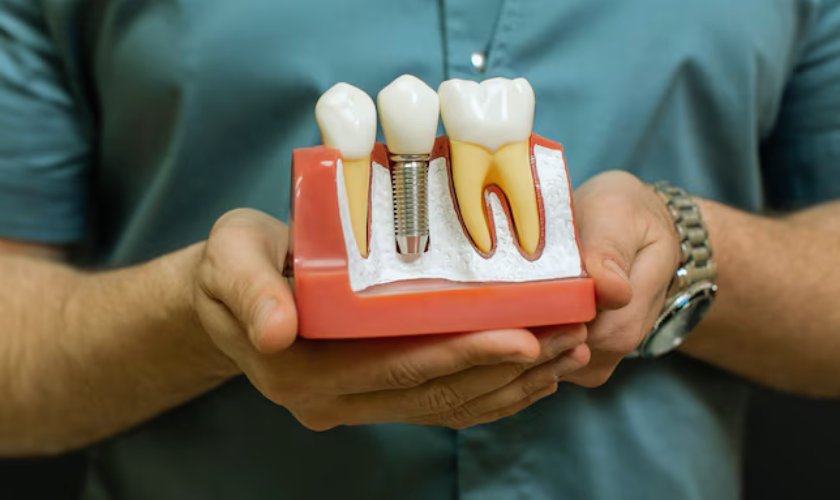 timeline & tips for dental implants recovery