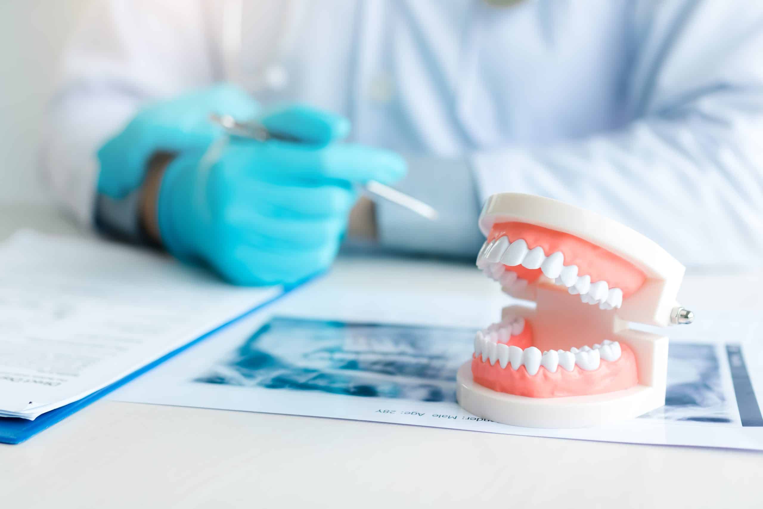 Full-arch-Implant-Restorations-In-McMurray-PA-scaled