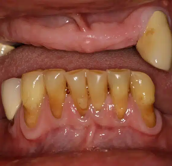 General Dentistry in New York