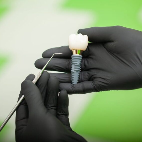 Dental Implants in New York City