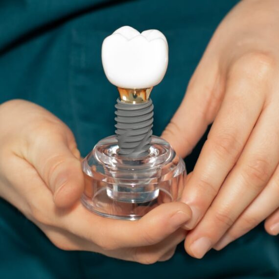 Dental Implants in New York City