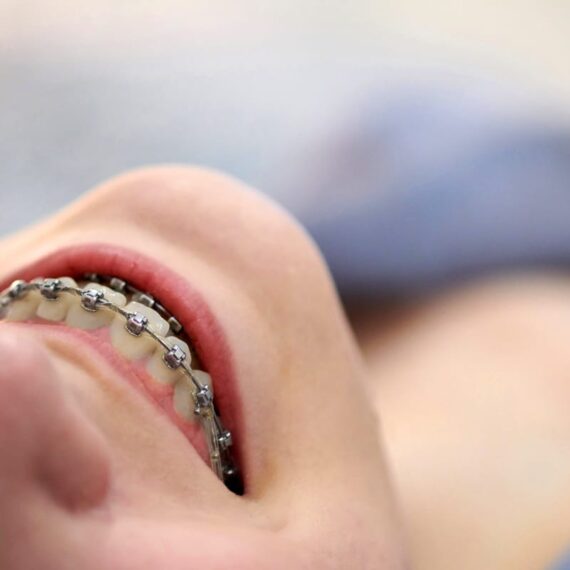 Orthodontics in East Village
