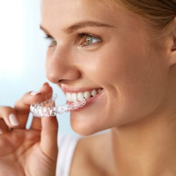 Clear Aligners in New York