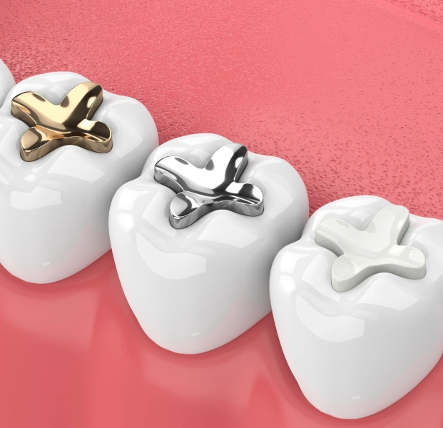 Dental crown and gold tooth restoration options on pink background