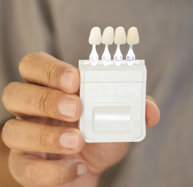 Dentist holding dental shade guide for tooth color matching