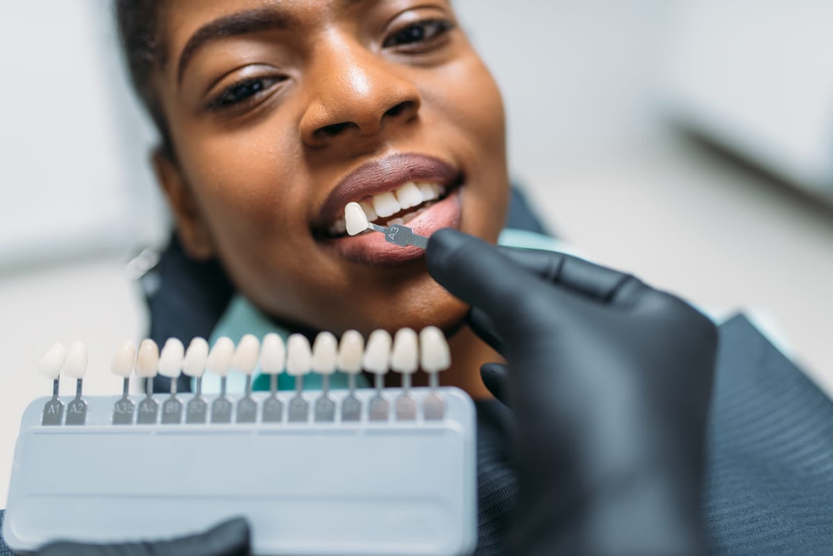 Veneers in Salem