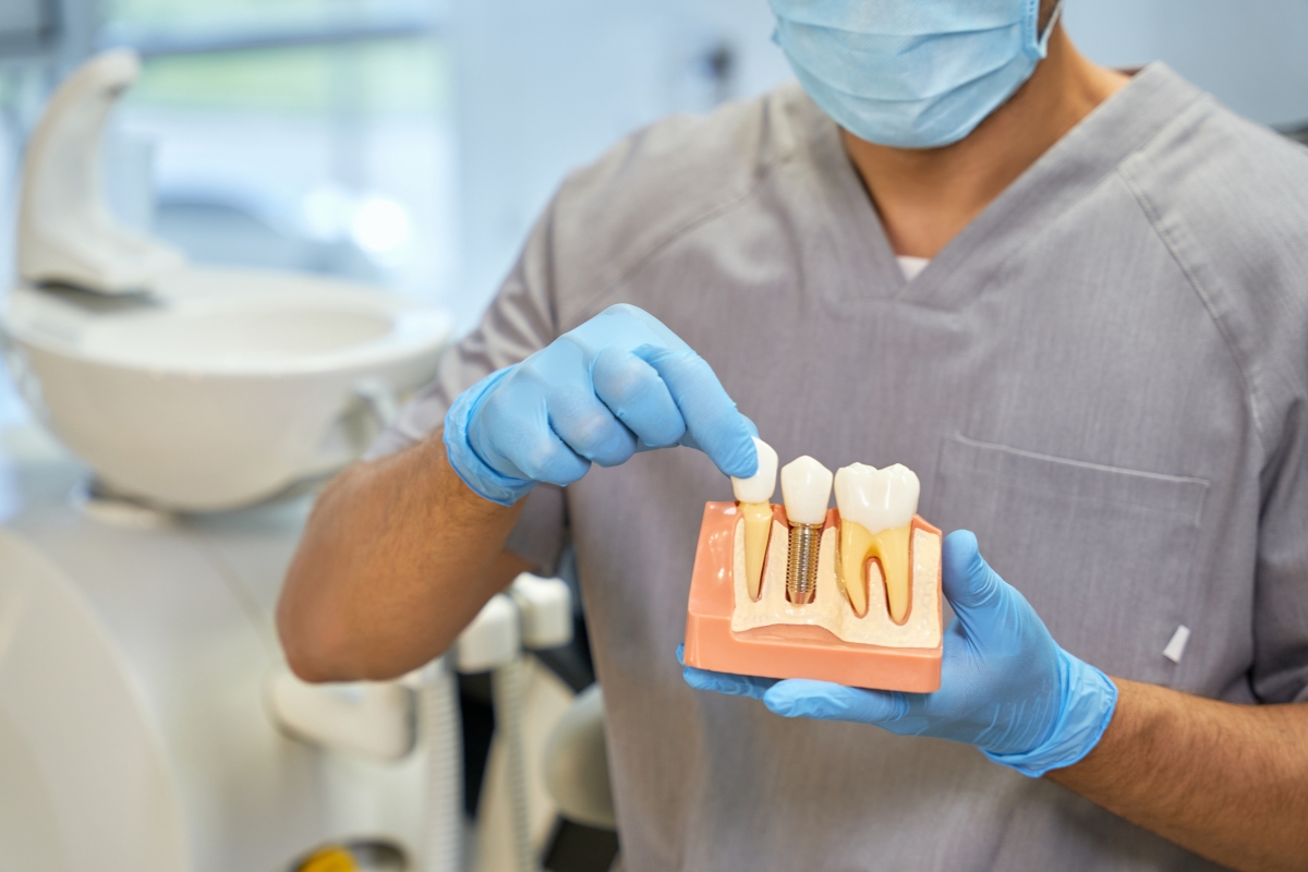 Dental implants in Frisco TX for restoring missing teeth at Panther Creek Dental.