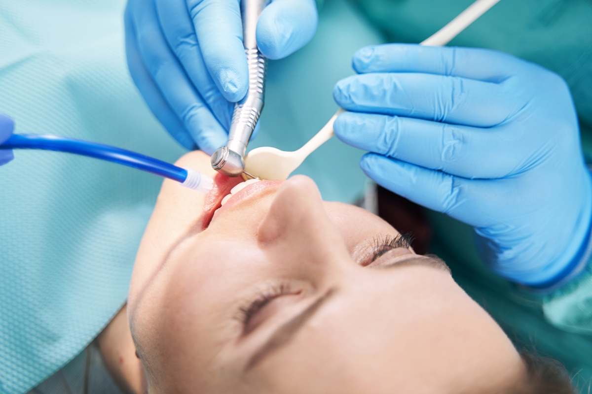 root-canal-treatment-in-Peachtree-Corners