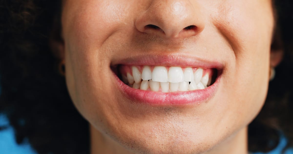 Periodontal Care in Norcross