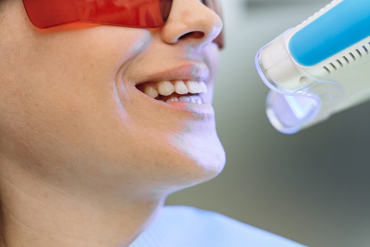 latest teeth whitening options in simpsonville