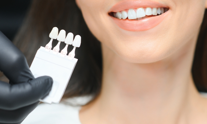 veneers in simpsonville sc