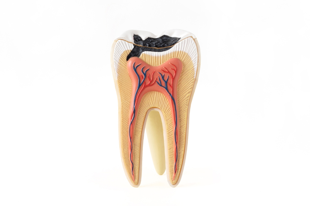 root-canal-treatment-in-Bridgeville