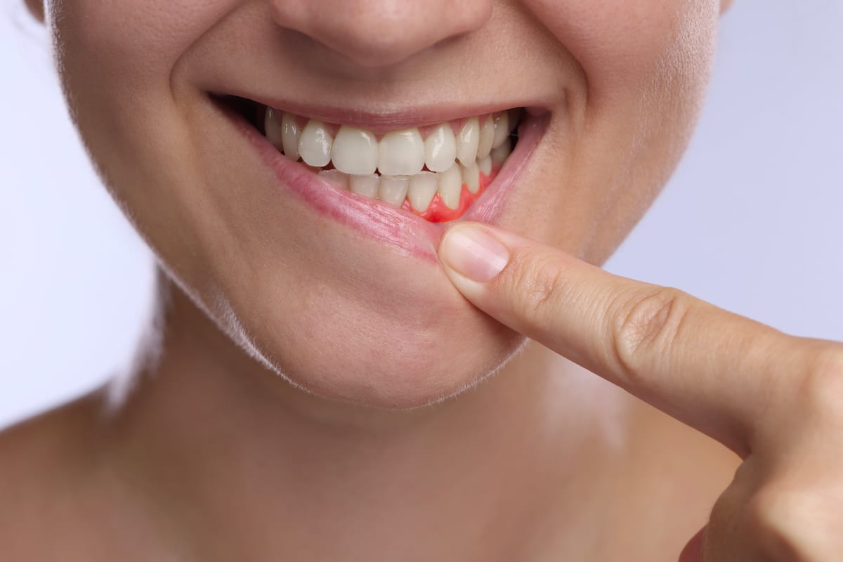 Gum Disease Treatment in Bridgeville