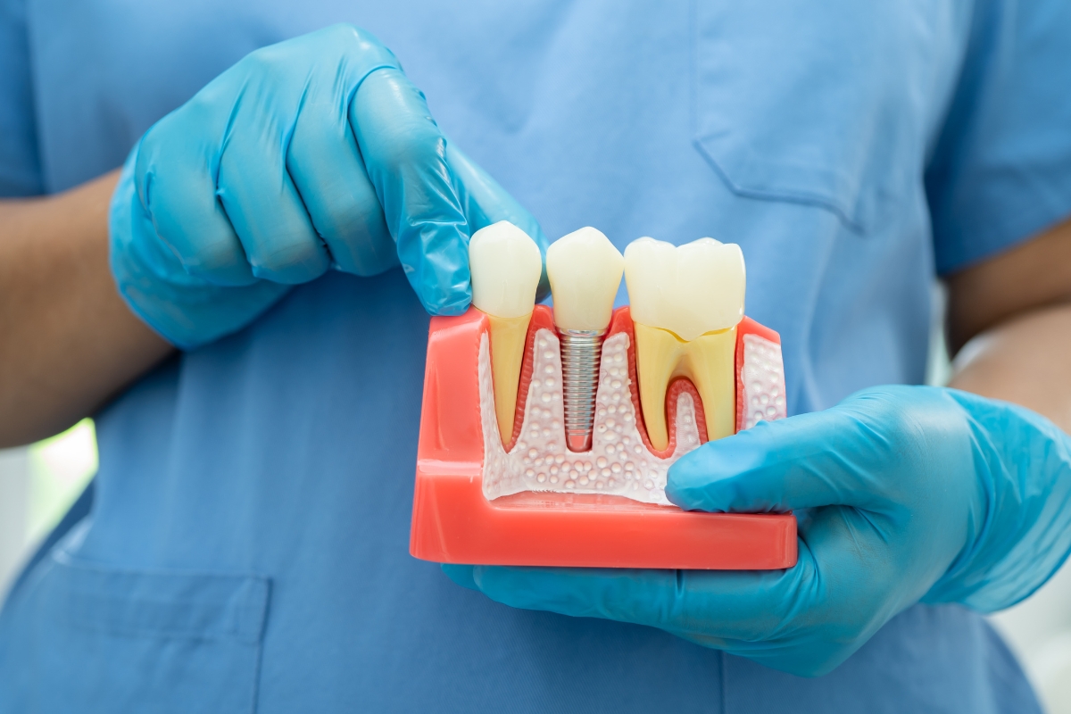 dental implants in Coraopolis