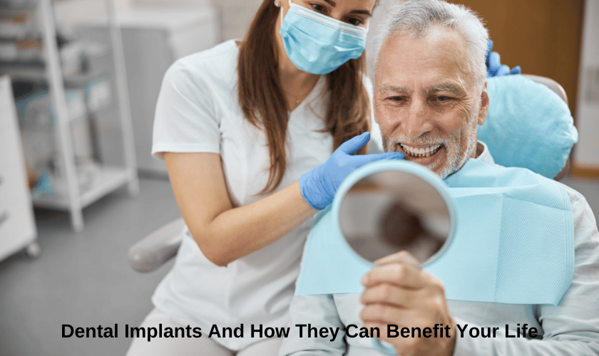 Dental implants