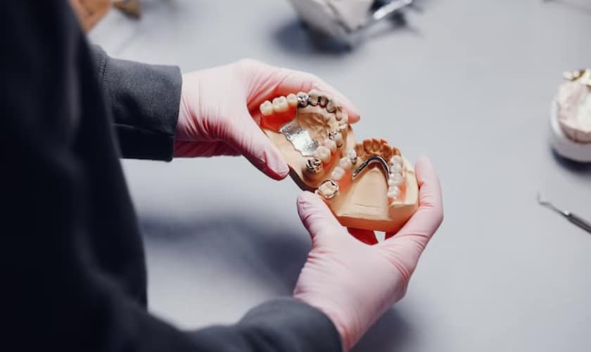 How Porcelain Veneers Can Address Common Dental Issues