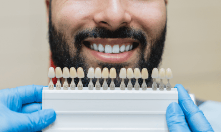 Porcelain Veneers