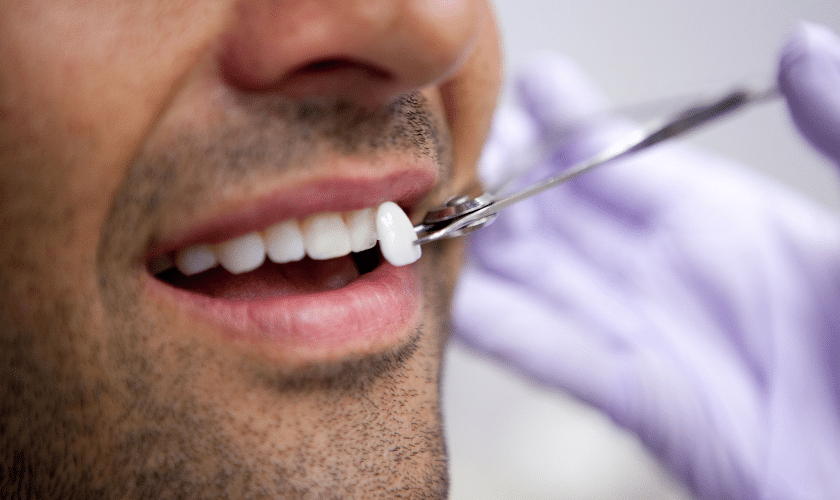 Dental Veneer Aftercare 7 Tips To Help You Protect Your New Smile 