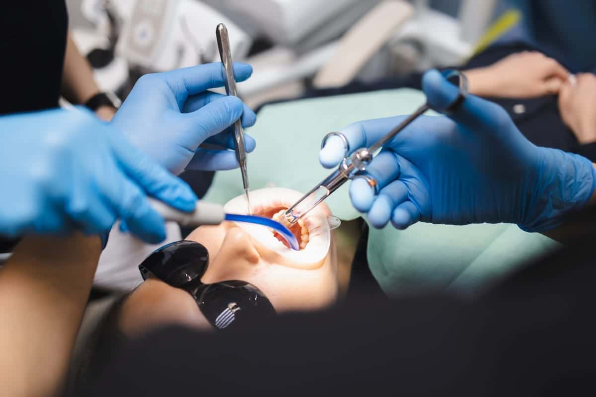 Root Canal Treatment in Yorkville