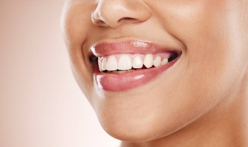 A patient after undergoing smile makeover with cosmetic dentist in Bellevue