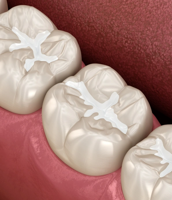Restorative Pediatric dentist Charlotte